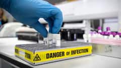 দেশে দাপট বাড়ছে টমেটো ফিভারের, ৫ বছরের নিচে আক্রান্তের সংখ্যা ৮২