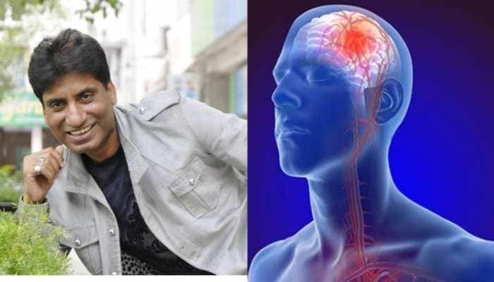 Brain Dead: What is the condition of brain dead, which Raju Srivastava is suffering from; Know what the scientists say Brain Dead : ਕੀ ਹੁੰਦੀ ਐ ਬ੍ਰੇਨ ਡੈੱਡ ਦੀ ਸਥਿਤੀ, ਜਿਸਨੂੰ ਝੱਲ ਰਹੇ ਨੇ ਰਾਜੂ ਸ਼੍ਰੀਵਾਸਤਵ ; ਜਾਣੋ ਵਿਗਿਆਨੀਆਂ ਦੀ ਕੀ ਕਹਿਣੈ