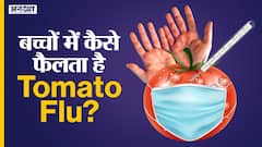 Tomato Flu: कैसे होता है Tomato Flu| क्या है symptoms| Monkeypox से है ज्यादा ख़तरनाक| Corona Virus