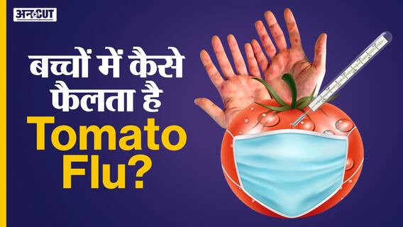 Tomato Flu: कैसे होता है Tomato Flu| क्या है symptoms| Monkeypox से है ज्यादा ख़तरनाक| Corona Virus