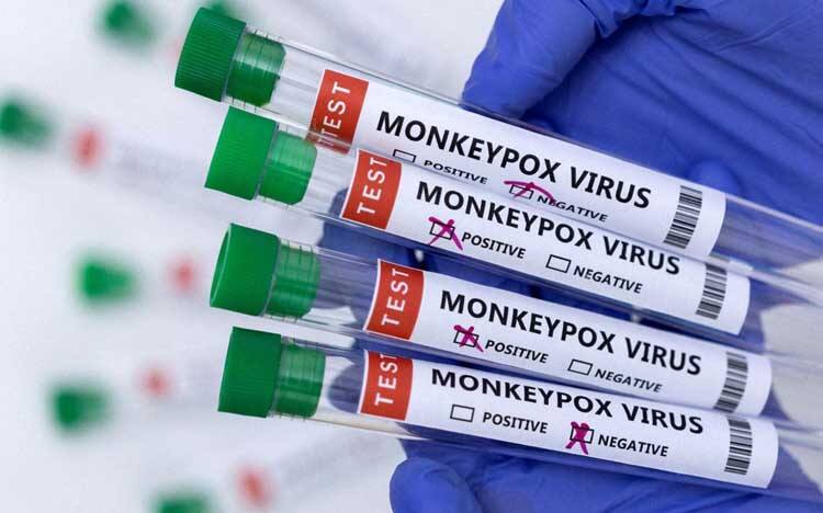 Monkeypox Bumps Cures: Do you know how long monkeypox bumps stay on the body? Know the recovery Monkeypox Bumps Cures : ਕੀ ਤੁਹਾਨੂੰ ਪਤਾ ਮੰਕੀਪੌਕਸ ਦੇ ਛਾਲੇ ਸਰੀਰ 'ਤੇ ਕਿੰਨੀ ਦੇਰ ਤਕ ਰਹਿੰਦੇ ਨੇ ? ਜਾਣੋ ਰਿਕਵਰੀ ਟਾਈਮ