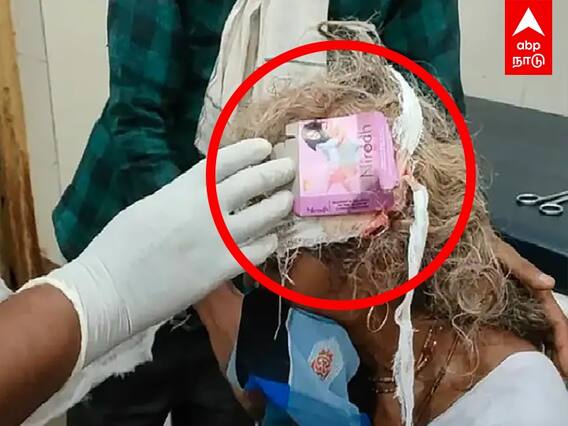 Madhya Pradesh : தலைக்காயத்திற்கு ஆணுறை பாக்கெட்டை வைத்துக்கட்டிய செவிலியர்.. என்ன நடந்தது?