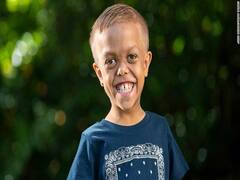 துன்புறுத்தப்பட்ட பழங்குடியின சிறப்பு குழந்தை இப்போ எப்படி தெரியுமா? ஆதரவு தெரிவித்த பிரபல நட்சத்திரங்கள் 