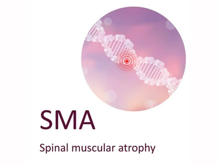 Understanding Spinal Muscular Atrophy Causes Symptoms Diagnosis SMA Genetic Disorder Understanding Spinal Muscular Atrophy — Causes, Symptoms And Diagnosis Of SMA Genetic Disorder