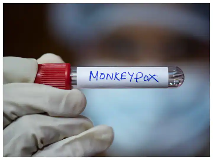 Monkeypox: เจ
เจฎเจฐเฉเจเจพ เจฆเฉ 50 เจธเฉเจฌเฉ monkeypox เจตเจพเจเจฐเจธ เจฆเฉ เจฒเจชเฉเจ 'เจ, เจเจ เจนเจซเจคเฉ 'เจ เจฆเฉเจจเฉเจ เจฆเฉ เจธเจญ เจคเฉเจ เจเจผเจฟเจเจฆเจพ เจฎเจพเจฎเจฒเฉ เจฏเฉเจเจธ 'เจ เจฎเจฟเจฒเฉ