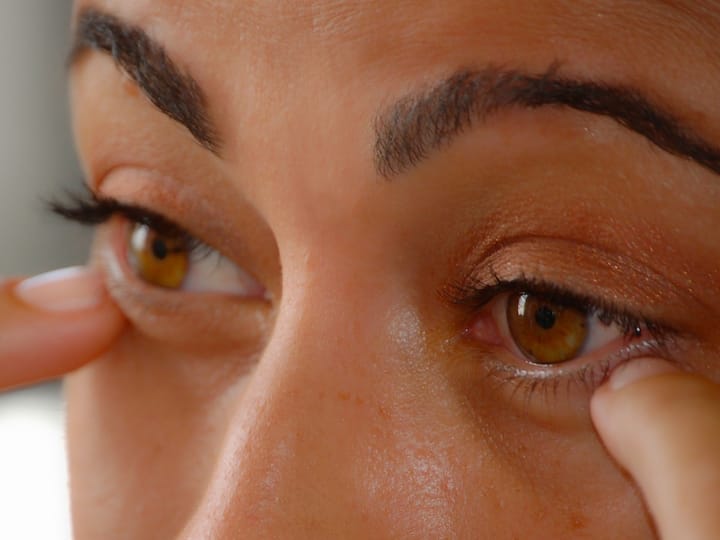 How Iron Deficiency Can Effect Your Eyes Iron Deficiency:  మీకు ఐరన్ లోపం ఉందో లేదో మీ కళ్ళే  చెప్పేస్తాయి