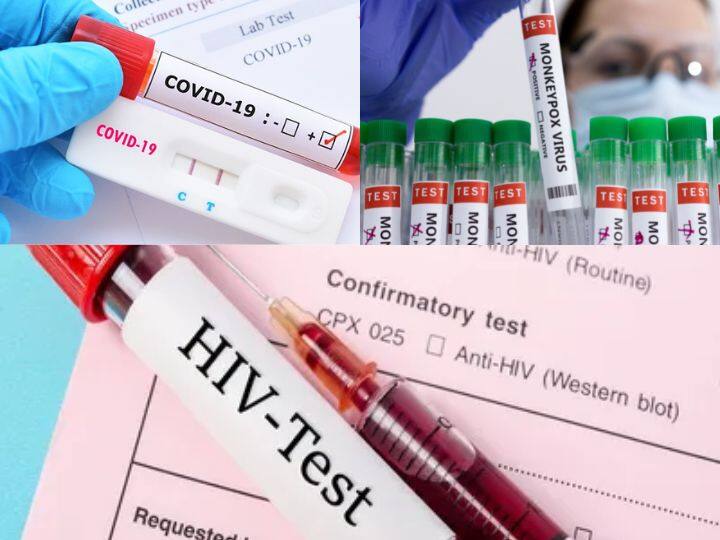 Man Tests Positive for Covid 19 Monkeypox HIV After Spain Trip First Known Case With all Three diseases at Same Time Covid Monkeypox HIV: સ્પેનના પ્રવાસેથી આવેલા વ્યક્તિને એક સાથે કોરોના, HIV અને મંકીપોક્સ થયો