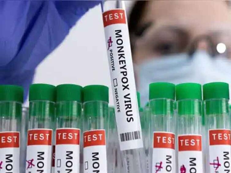 British scientists behind key COVID trial launch study to test monkeypox treatment MonkeyPox treatment:  कोविड लशीची मोहीम फत्ते करणाऱ्या ब्रिटीश शास्त्रज्ञांचे लक्ष मंकीपॉक्स उपचारांवर!
