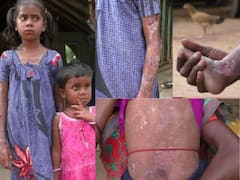 பகுத்தறியமுடியாத நோயால் பெரும் துயரத்தில் பழங்குடி சிறுமிகள்: முதல்வரிடம் கண்ணீர் மல்க உதவிகேட்டும் குடும்பம்