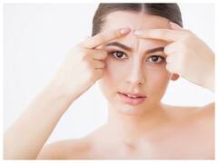 Causes of Pimples: पिम्पल्स का बढ़ने का कारण है आपकी मॉर्निंग की ये बेड हैबिट