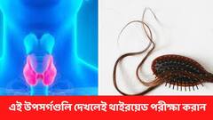 বাড়ছে ওজন ? অসম্ভব ক্লান্তি ? আর কোন কোন লক্ষণ দেখলেই থাইরয়েড পরীক্ষা করাবেন ?