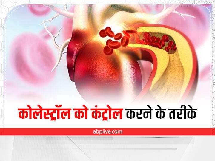 Reduce Cholesterol Naturally: कोलेस्ट्रॉल लेवल को कम करने के लिए आप अपनी डायट में कुछ बदलाव कर सकते हैं. जैसे कि आप अपनी डायट में दलिया, राजमा, सेब और ब्रसेल्स स्प्राउट्स को शामिल कर सकते हैं.