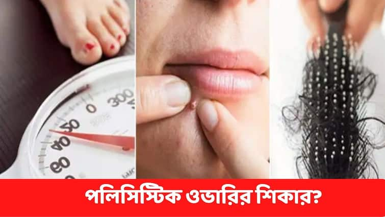  Polycystic ovarian syndrome PCOS  Know How Can It Be Detected And Controlled PCOS : পলিসিস্টিক ওভারিয়ান সিনড্রোমে ভুগছেন ? কী খাবেন, কী খাবেন না ?