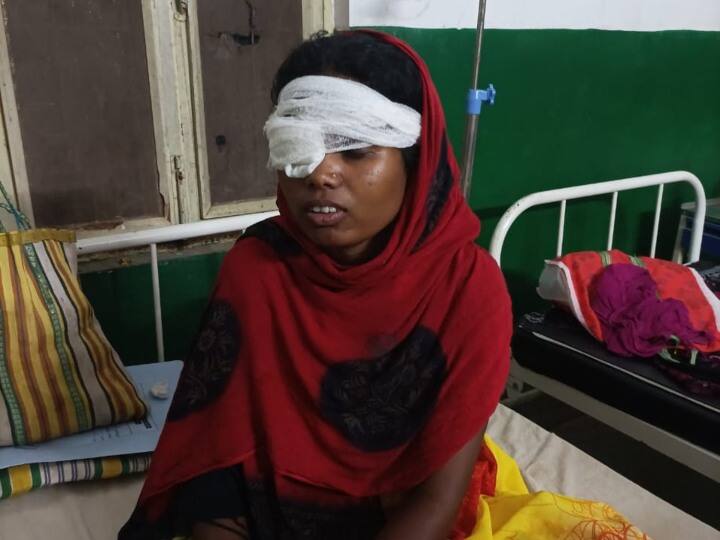 Surguja husband put his finger and took out one eye of wife over going to the maternal house ANN Surguja News: सरगुजा में बेरहम पति ने हसुए से निकाली बीवी की एक आंख, मायके जाने से था नाराज