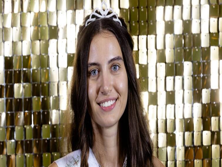 Meet 20-year old Miss England finalist competing without makeup Without Makeup : அழகி போட்டியில் மேக்கப் இல்லாமல் போட்டியிடும் இளம்பெண்.. ஒரு வாவ் கதை..