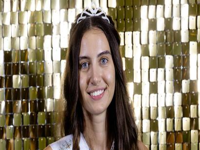 Meet 20-year old Miss England finalist competing without makeup Without Makeup : அழகி போட்டியில் மேக்கப் இல்லாமல் போட்டியிடும் இளம்பெண்.. ஒரு வாவ் கதை..