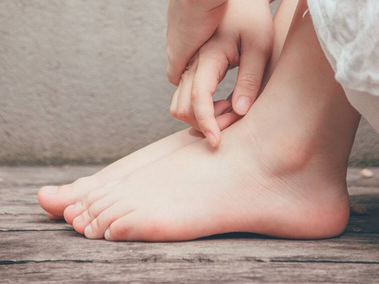 How to remove foot cracks know the easy tips Foot Cracks: পা-ফাটার সমস্যা দূর করতে কীভাবে পায়ের যত্ন নেবেন? রইল কিছু সহজ টিপস