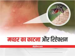 मच्छर के काटने से हो रही है जलन? आजमाएं ये घरेलू नुस्खे, तुरंत मिलेगा आराम