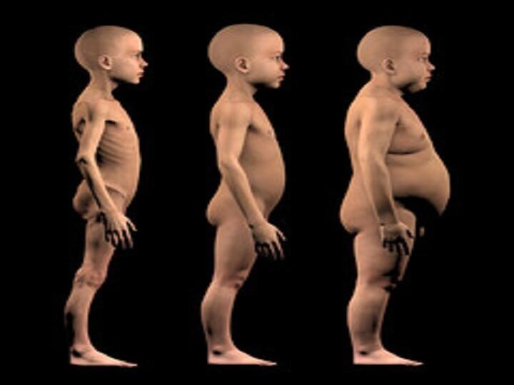 सांप-सीढ़ी का खेल बना कुपोषण से लड़ने का नायाब तरीका, PM मोदी भी हैरान