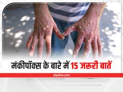 भारत समेत दुनियाभर में बढ़ रहे हैं मंकीपॉक्स के मामले, इस बीमारी के बारे में जानें 15 जरूर बातें