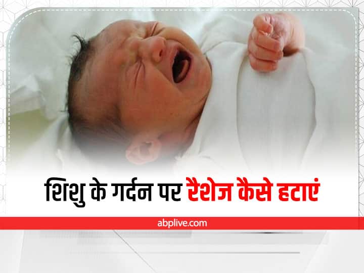 How to Cure Neck Rashes in Babies in Hindi बरसात में छोटे बच्चे के गर्दन पर हो सकती है रैशेज की समस्या, इन उपायों से पाएं राहत