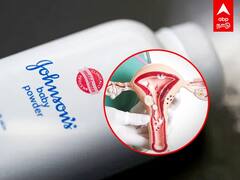 Johnson Powder : அமெரிக்கா, கனடாவில் தடை.. இந்தியாவில் தொடரும் தயாரிப்பு! சர்ச்சையில் ஜான்சன் பவுடர்