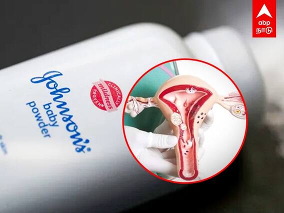 Johnson Powder : அமெரிக்கா, கனடாவில் தடை.. இந்தியாவில் தொடரும் தயாரிப்பு! சர்ச்சையில் ஜான்சன் பவுடர்