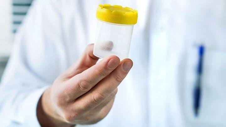 ਆਮ ਤੌਰ 'ਤੇ ਪਿਸ਼ਾਬ ਨਾਲ ਜੁੜੀਆਂ ਸਮੱਸਿਆਵਾਂ ਨੂੰ ਕਿਡਨੀ ਫੇਲ ਹੋਣ ਦੇ ਲੱਛਣ ਵਜੋਂ ਦੇਖਿਆ ਜਾਂਦਾ ਹੈ।