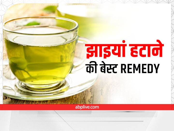 What Is Pigmentation Home Remedy For Hyperpigmentation How Green Tea Helps In Pigmentation Main Reason Of Pigmentation Pigmentation Prevention: समय से पहले झाइंया आपको बूढ़ा बना सकती है, जानिये कैसे ग्रीन टी से ठीक हो सकती है ये परेशानी