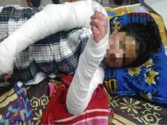 झारखंड: अंकिता को असहनीय जलन होने पर पिता ने किया था ये काम, अब सामने आई बड़ी बात  