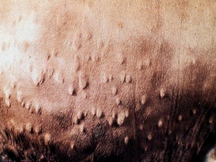 लम्पी त्वचा रोग हा केवळ गोवंश जनावरांना होणारा विषाणूजन्य त्वचारोग आहे... लम्पी स्किन आजार हा कीटकांपासून पसरतो... त्यामुळं पशुपालकांनी आपल्या जनावरांची योग्य ती काळजी घेणं गरजेचं आहे.