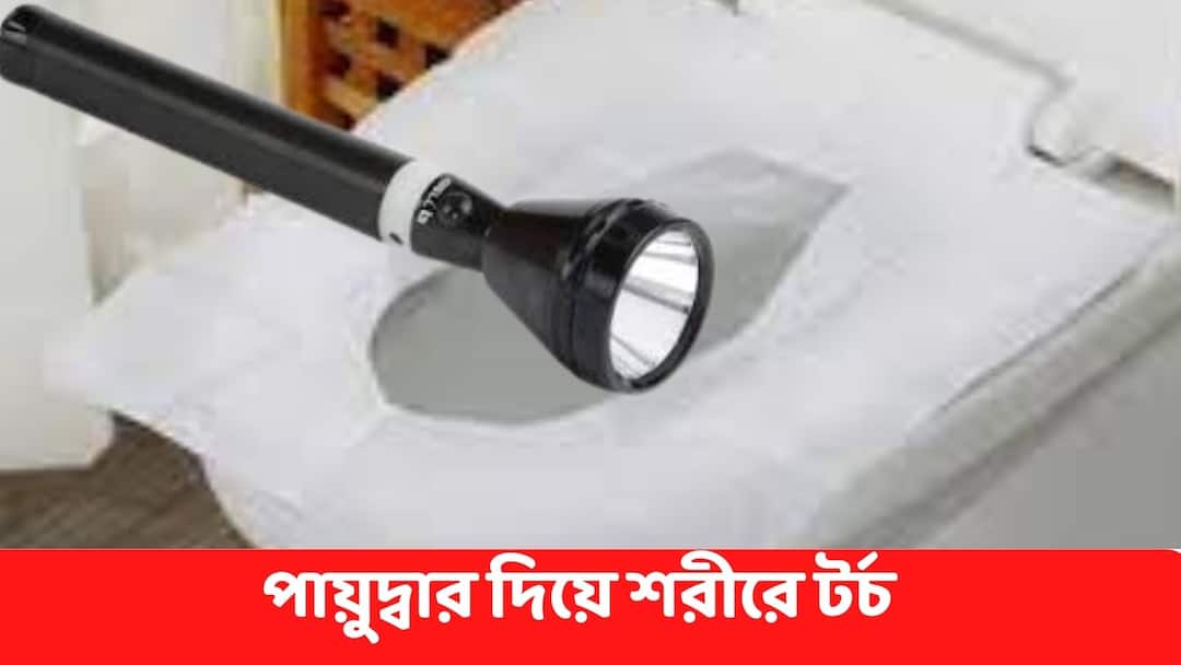 Burdwan News : পায়ুদ্বার দিয়ে শরীরের ভিতরে টর্চ ! প্রাণ বাঁচাতে অপারেশন Burdwan News Torch inserted inside the body through the anus, doctor performed Operation to save life Burdwan News : পায়ুদ্বার দিয়ে শরীরের ভিতরে টর্চ ! প্রাণ বাঁচাতে অপারেশন