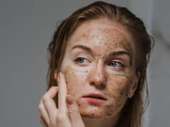 ত্বকের র‍্যাশ-জ্বালা-লালচে ভাব দূর করতে কীভাবে যত্ন নেবেন?