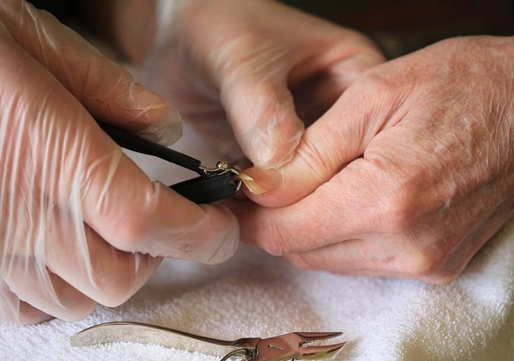 Why not feel pain when cut our nails reason Interesting Fact: आखिर नाखून कटने पर बाकी जगह की तरह दर्द क्यों नहीं होता, जानिए कारण