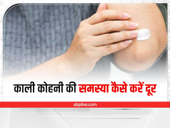 how to get rid of dark elbows in hindi कोहनी का कालापन बन सकता है शर्मिंदगी का कारण, इन तरीकों से करें दूर