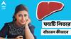 Fatty Liver : ফ্যাটি লিভারের সমস্যায় ভুগছেন, অথচ মন বলে খাই-খাই? পুজোয় ভুলেও ভাঙবেন না এই নিয়ম