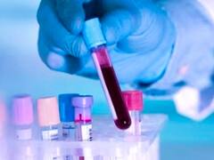 Rajasthan News: राजस्थान के अस्पतालों में 40 तरह की मुफ्त जांच सुविधा पर ब्रेक, सेंटर्स पर लटका ताला