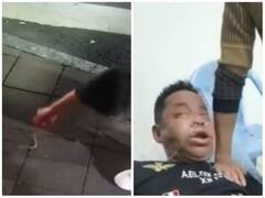 सांप को छेड़ना शख्स को पड़ा भारी, जहर से फूल गया पूरा चेहरा