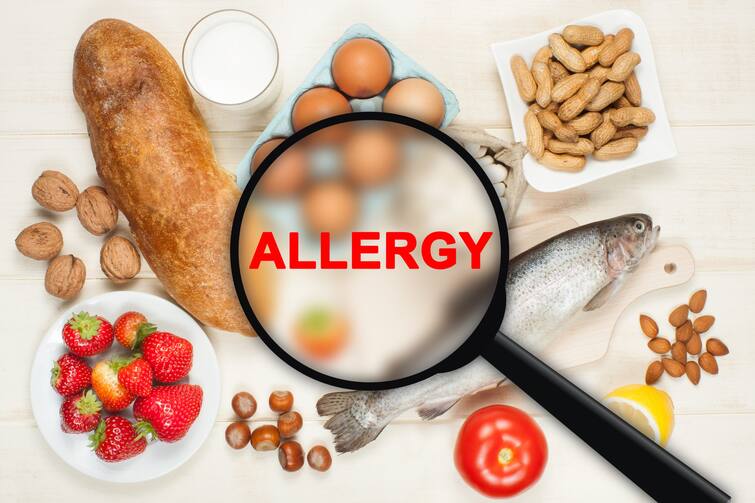 Health News Symptoms and Treatment of Food Allergies in Infants and Toddlers Food Allergy : शिशु आणि लहान मुलांना होणाऱ्या फूड अॅलर्जीची लक्षणे आणि उपाय