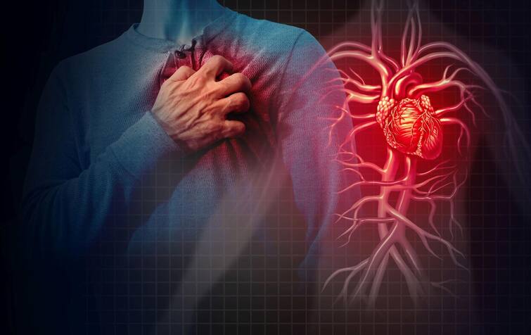High Cholesterol Risk For Heart Disease Best Oil For Heart Refined Oil Harmful For Health