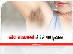 Dark Under Arms Remedy: जानें काले अंडर आर्म्स की वजह और इनसे छुटकारा पाने के घरेलू नुस्खे