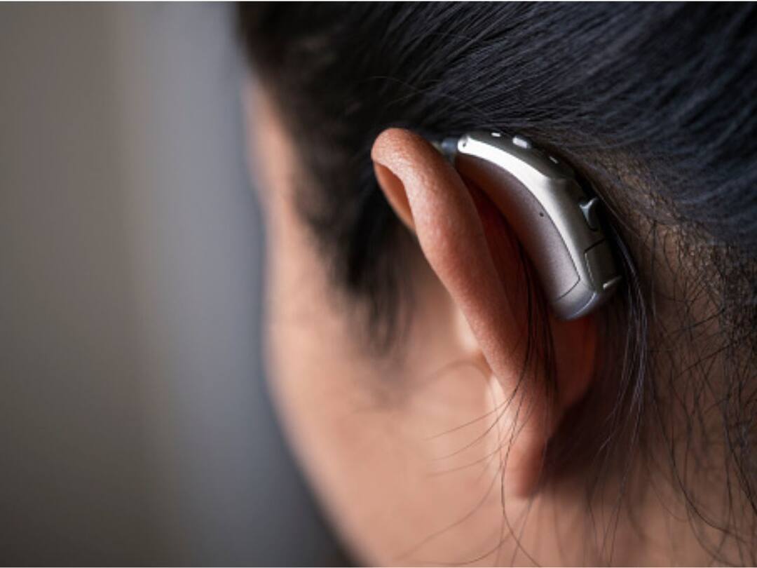 This Clip-On Ear Device Can Treat Indigestion: Study This Clip-On Ear Device Can Treat Indigestion: Study This Clip-On Ear Device Can Treat Indigestion: Study