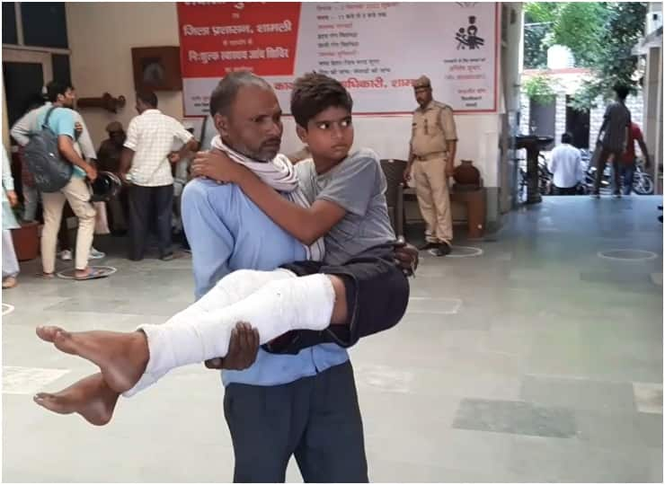 shamli inter college principal beaten up a student with stick as latter reached late ann Shamli: पांच मिनट देरी से पहुंचा स्कूल तो प्रिंसिपल ने निर्ममता से पीटा, छात्र का दोनों पैर टूटा