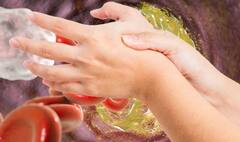 High Cholesterol Signs : ਹੱਥਾਂ ਵਿੱਚ ਦਿਖਾਈ ਦਿੰਦੇ ਨੇ ਅਜਿਹੇ ਸੰਕੇਤ ਤਾਂ ਬਿਨਾਂ ਦੇਰੀ ਤੁਰੰਤ ਡਾਕਟਰ ਨਾਲ ਕਰੋ ਸੰਪਰਕ