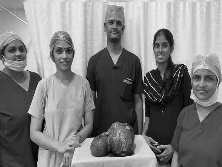 6 kg fibroid mass removed from 50-year-old in Hyderabad முதுகுவலிக்கு டாக்டரிடம் சென்ற பெண்! வயிற்றில் இருந்த 6 கிலோ கட்டி! பரிசோதனையில் தெரிந்த ஷாக்!