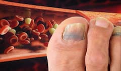 Cholesterol Symptoms: বেশি হাঁটলে পায়ে ব্যথা? কী ইঙ্গিত দিচ্ছে আপনার শরীর?