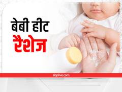 बच्चों को हीट रैशज होने पर इस तरह रखें ध्यान, तुरंत मिलेगी राहत