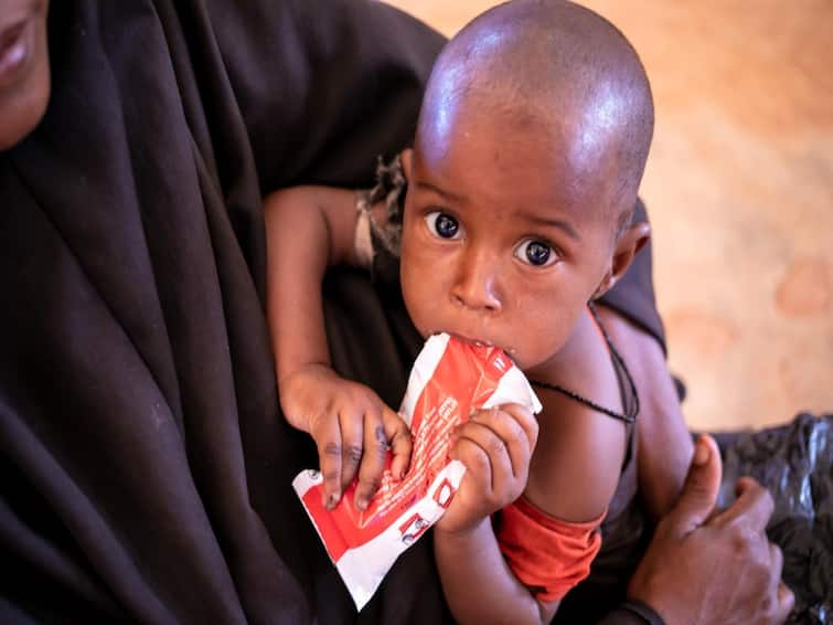 More than 700 children have died in Somalia nutrition centres, UN says Somalia : கொத்துக்கொத்தாக குழந்தைகள் இறப்பார்கள்! ஐநா சொன்ன பகீர் தகவல்! சோமாலியாவின் சோகம்!