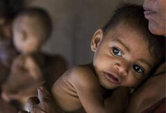 ਸਿਟੀ ਬਿਊਟੀਫੁੱਲ ਦੀ ਹਾਲਤ ਵਿਗੜੀ, 20 ਫੀਸਦੀ ਤੋਂ ਵੱਧ ਬੱਚੇ ਕੁਪੋਸ਼ਣ ਦਾ ਸ਼ਿਕਾਰ