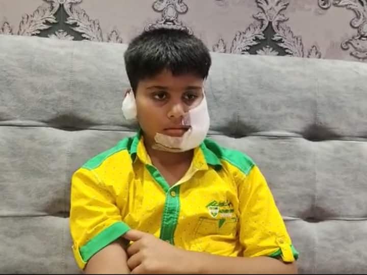 Pitbull Dog bites 11 year old boy in Ghaziabad survived after surgery ANN Ghaziabad Dog Attack: गाजियाबाद में पिटबुल नस्ल के कुत्ते ने बच्चे को बुरी तरह काटा, 200 टांके के बाद बची जान